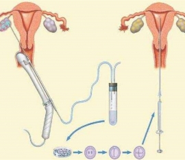 35岁女性备孕请做好以下检查，“健康哈尔滨代生宝宝”跑不远